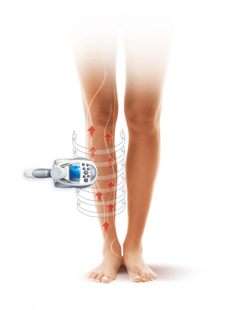 838-Jambes-lourdes