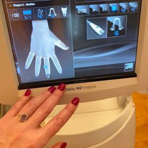 Hand_2